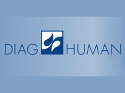 Diag Human: Naše pokusy o jednání vždy vláda odmítla