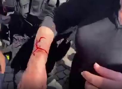 VIDEO Na Babišově mítinku tekla krev. Důchodkyně na zemi