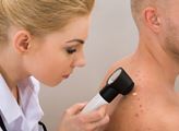 Česká průmyslová zdravotní pojišťovna: Kampaň proti melanomu nabídne vyšetření zdarma ve 12 městech