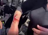 VIDEO Na Babišově mítinku tekla krev. Důchodkyně na zemi