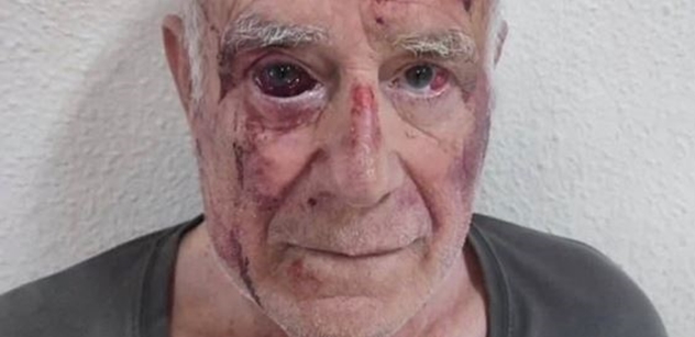 Ve Španělsku napaden senior. Nejspíš migranty, plnili výzvu z internetu