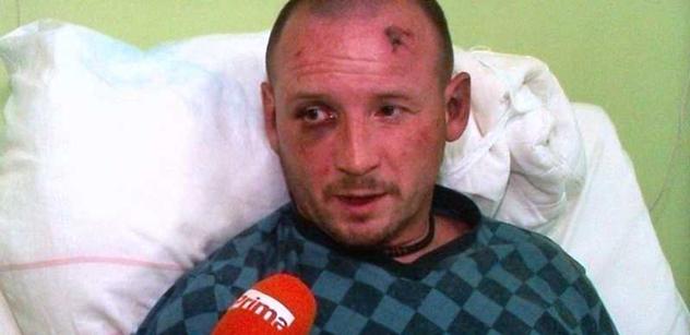 FOTO Romové útočili. Muž skončil po brutálním napadení v nemocnici