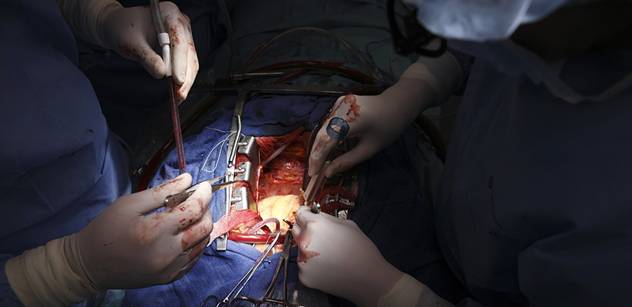 Češi budou moci přijímat orgány k transplantaci i od zemřelých cizinců